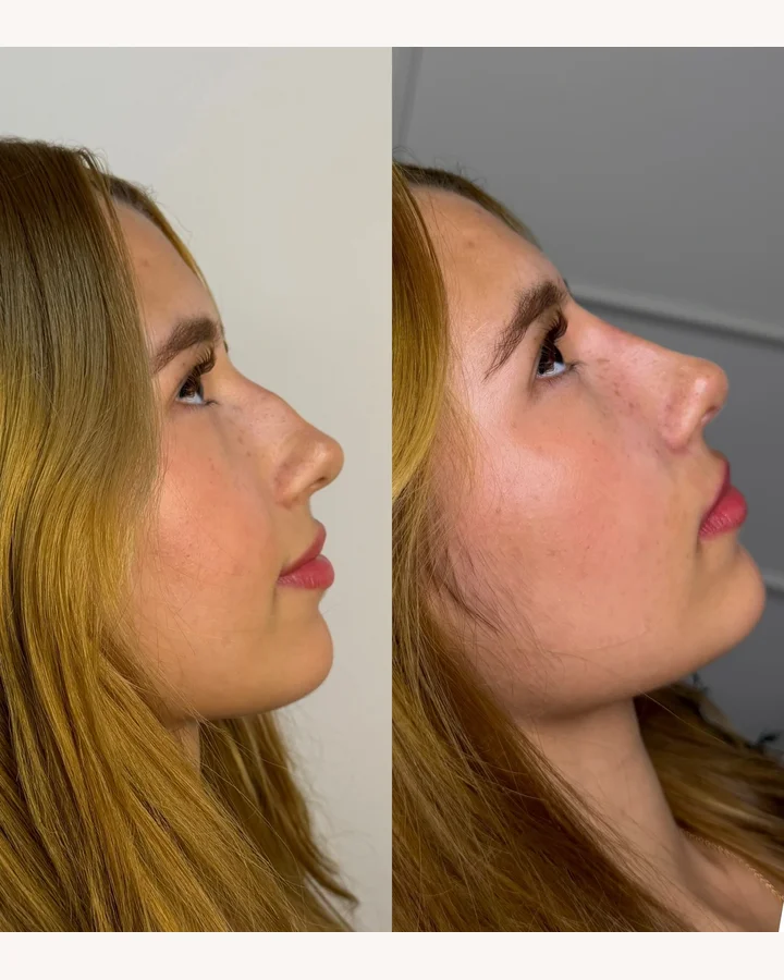 Resultado antes e depois 3
